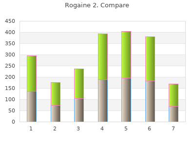 generic 60 ml rogaine 2 with visa