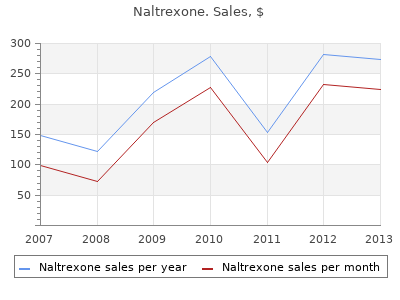 50mg naltrexone overnight delivery