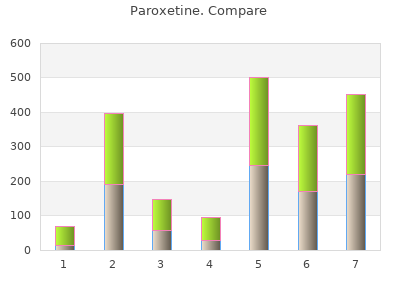 order paroxetine 30 mg with amex
