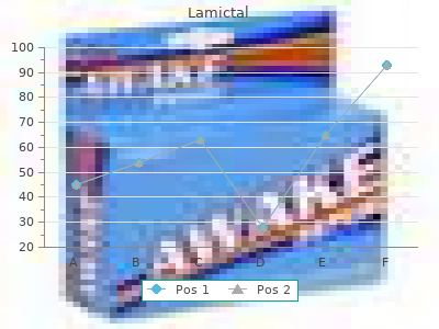 cheap 25 mg lamictal fast delivery