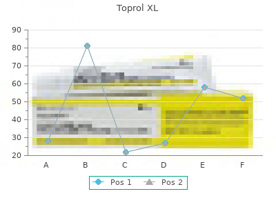 buy toprol xl 100 mg amex