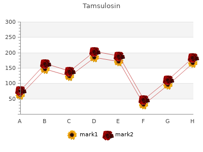 purchase tamsulosin 0.2 mg fast delivery