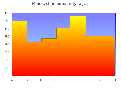 50 mg minocycline